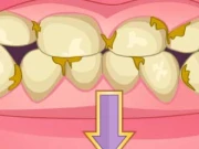 Bad Teeth Makeover Online Care Games on taptohit.com